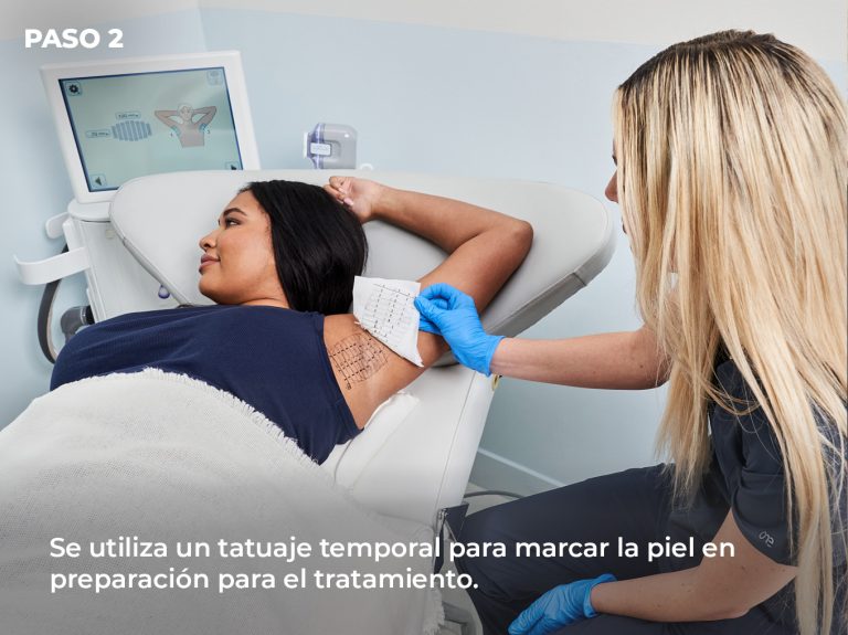 Marcacion-tratamiento-hiperhidrosis-axilar