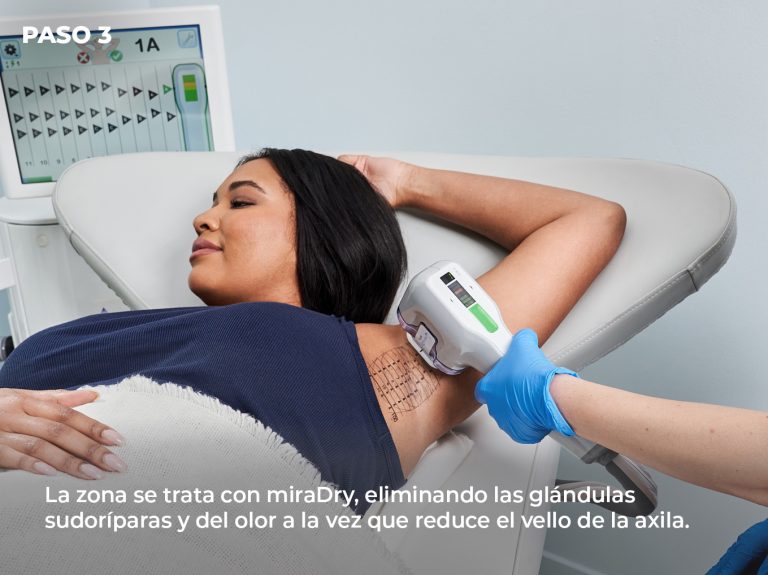 microondas-miradry-tratamiento-hiperhidrosis